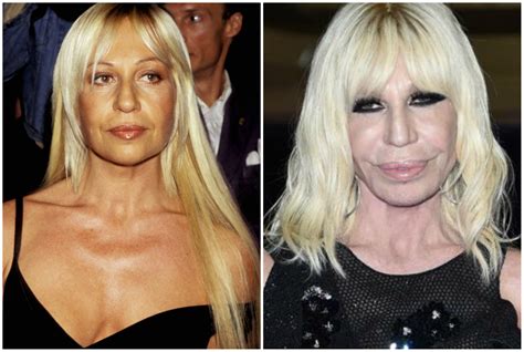 do atella versace prima|donatella versace real face.